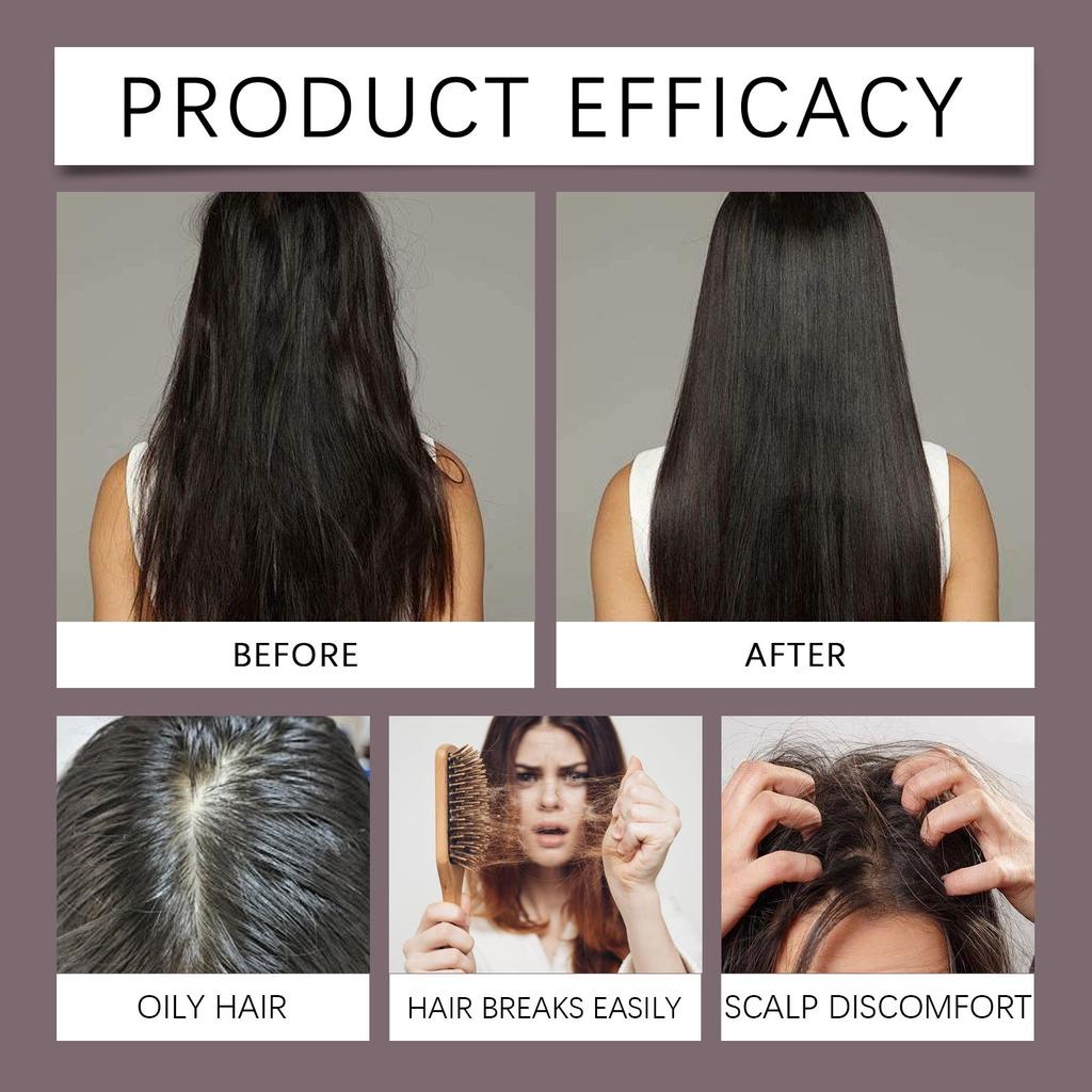 Shampoo Promote Hair Growth, Improves Hair Loss And Thinning, And Moisturizes And Cleanses The Scalp,100ml