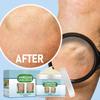 Vein Cream Relieves The Pain Of Blue Veins And Red Blood Streaks Earthworm Legs