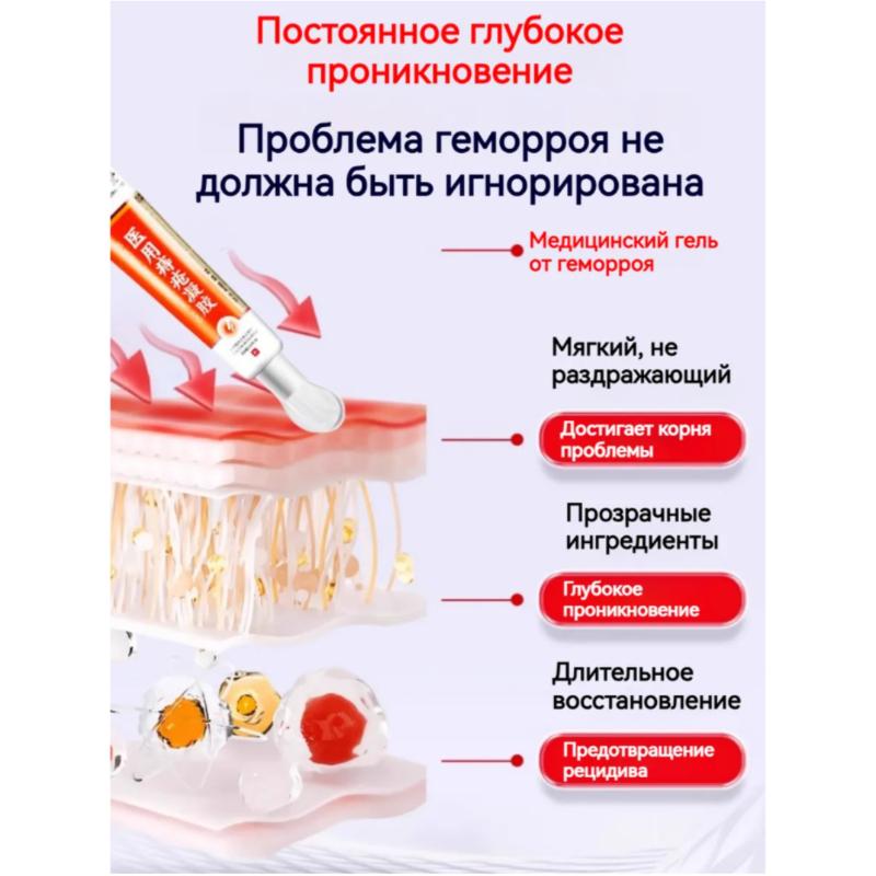 Chinese Hemorrhoid Ointment for Piles and Fissures, 20 Ml