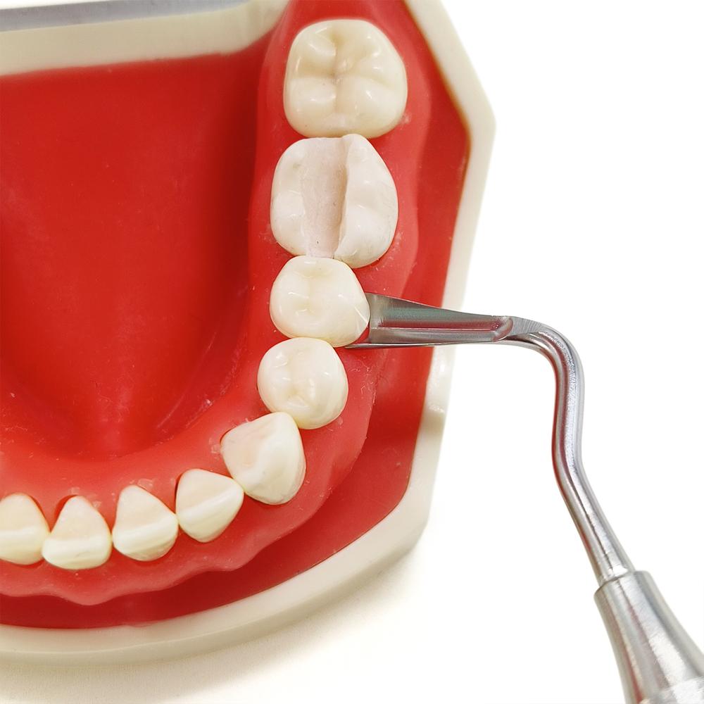 Nerezový zubný implantát, gingiválny retraktor, gingiválna retrakcia, zubný separátor ďasien, izolácia chirurgického nástroja s dvojitými koncami