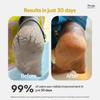 Deyga Foot Cream Trial Pack | For Dry And Cracked Feet | Moisturizes Rough Heels | Suitable For All Skin Types| Foot Butter For Men & Women| Preven