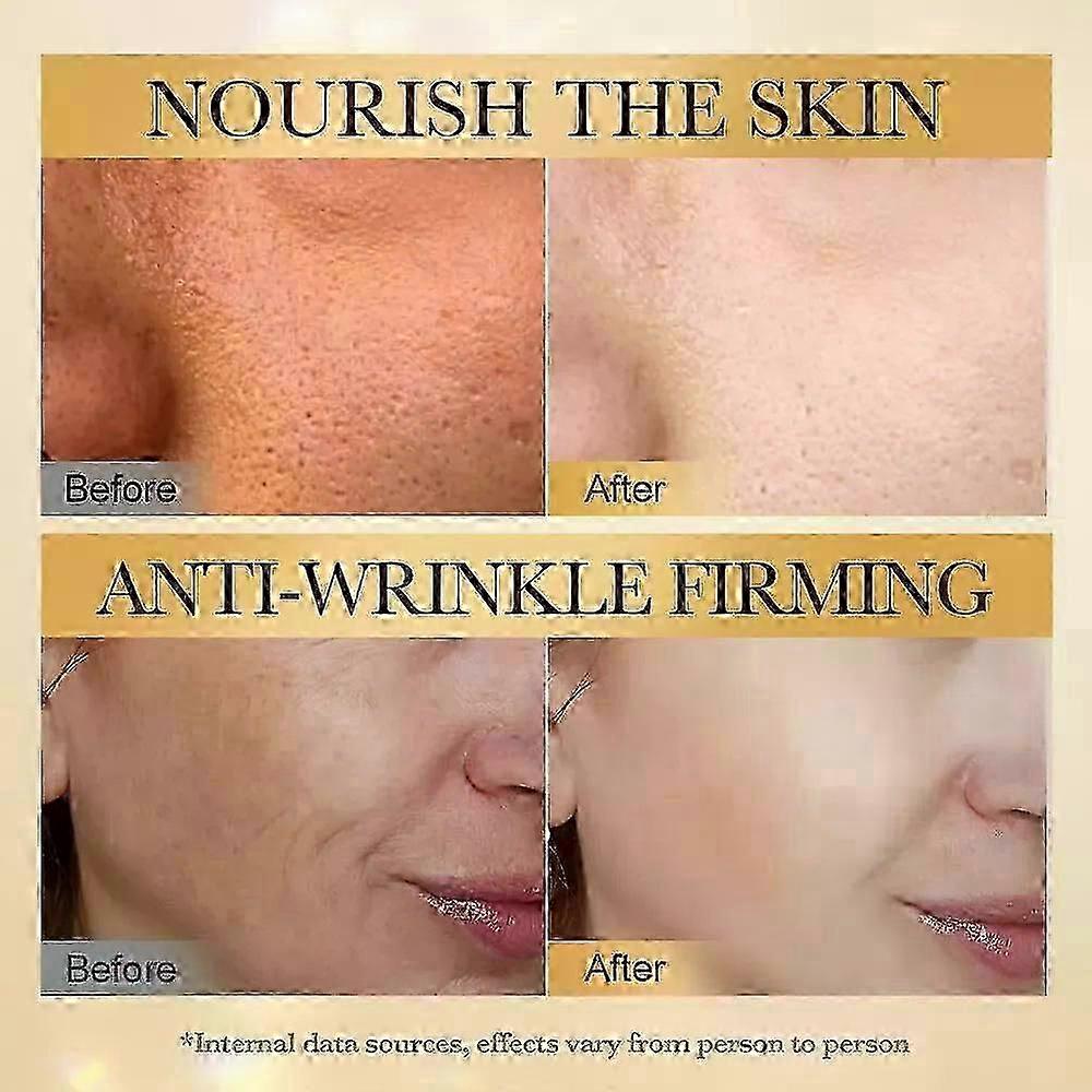 Anti-wrinkle Firming Serum,anti-aging Lifting Essence,wrinkle Lifting Essence
