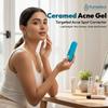 Gel Acné Yumedics - 30 ml Gel Correcteur de Boutons d'Acné Léger Ceramed - Pour Peaux à Tendance Acnéique et Sensibles, Correcteur de Boutons d'Acné Facile à Utiliser