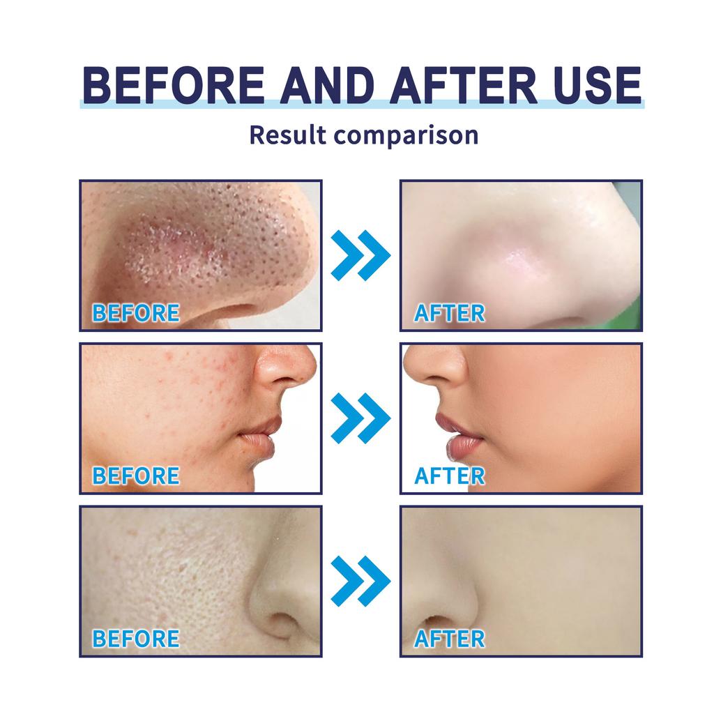 EELHOE Bambusmaske zur Entfernung von Mitessern, schwarze Kohle-Peel-Off-Gesichtsmaske mit Schlamm, Tiefenreinigung, verkleinerte Poren, Anti-Akne-Hautpflege, 100 g