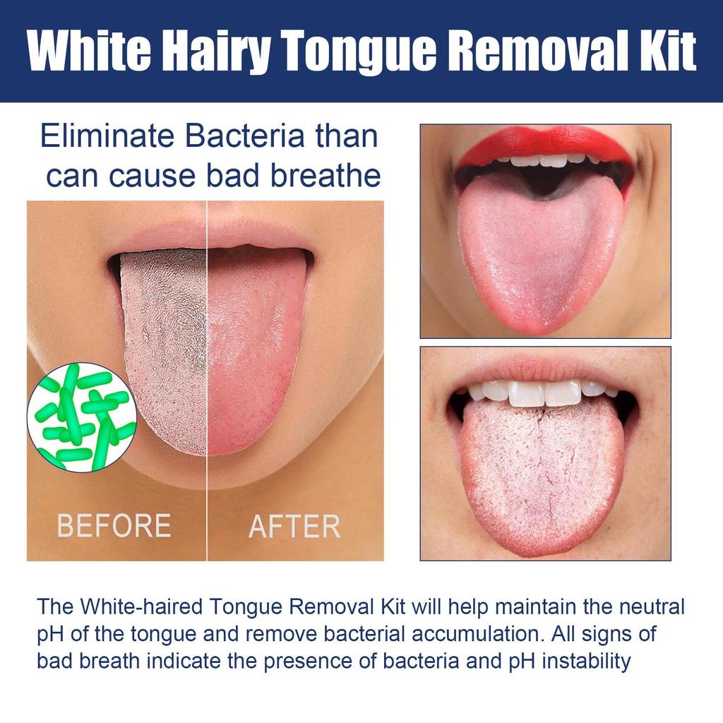 Jaysuing Tongue Cleaning Kit (50g + Oral Cleaning and Care Tongue Brush) - Improves Bad Breath, Cleans the Tongue, and Provides Oral Hygiene Care.