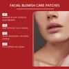 Microneedle Plant-based Skin Care Patches, Acne-reducing Patches, Covering Areas And Blemishes