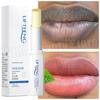 Remove Dark Smoke Lip Balm Lightening Melanin Bleaching Gloss Oil Lips Pink Lipstick Exfoliating Fade Lip Lines Korean Cosmetics