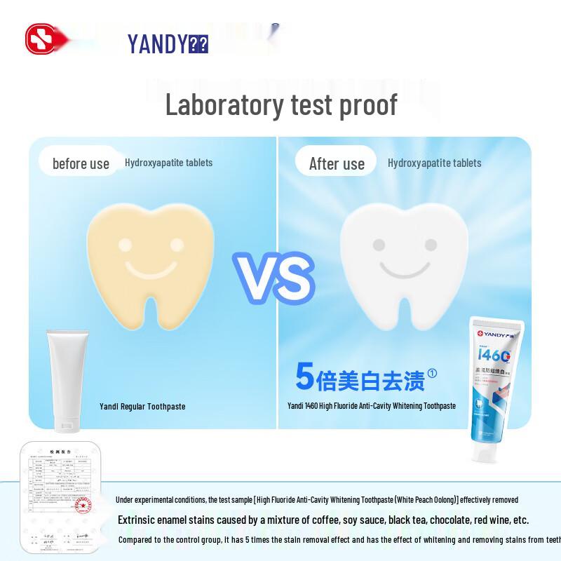 YANDY High Fluoride Whitening & Anti-Cavity Toothpaste