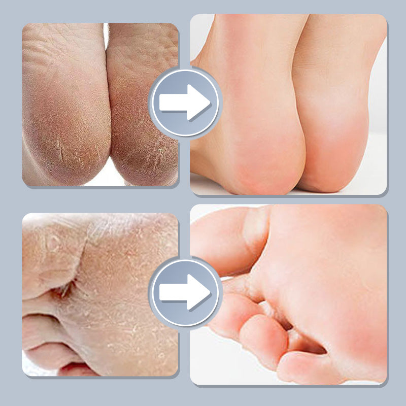 Household Adjustable Electric Foot Callus Remover Waterproof Foot File Grinder Tool for Feet Dry Dead Skin Pedicure Tools