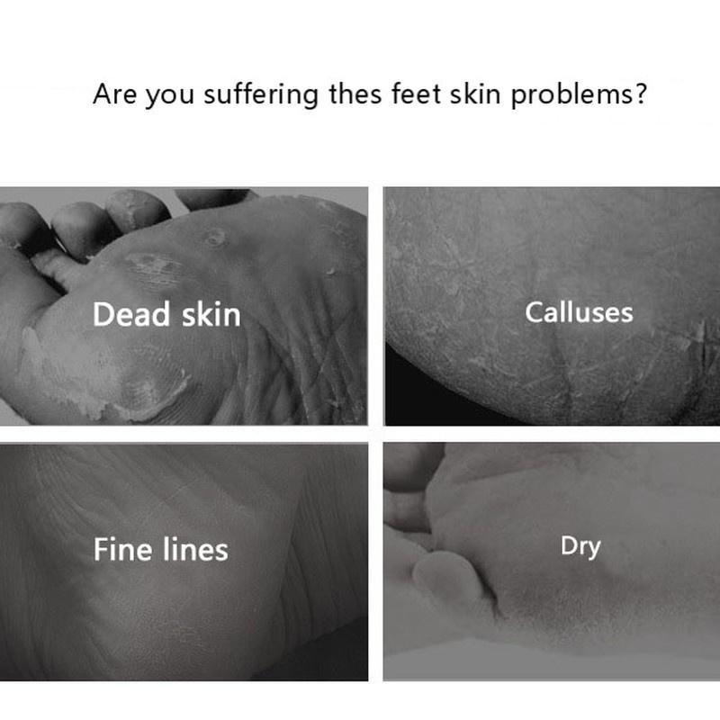 1Pair Exfoliating Foot Mask Foot Patch Magic Skin Peeling Dead Skin Feet Mask Socks Sosu Socks for Pedicure Socks Cream