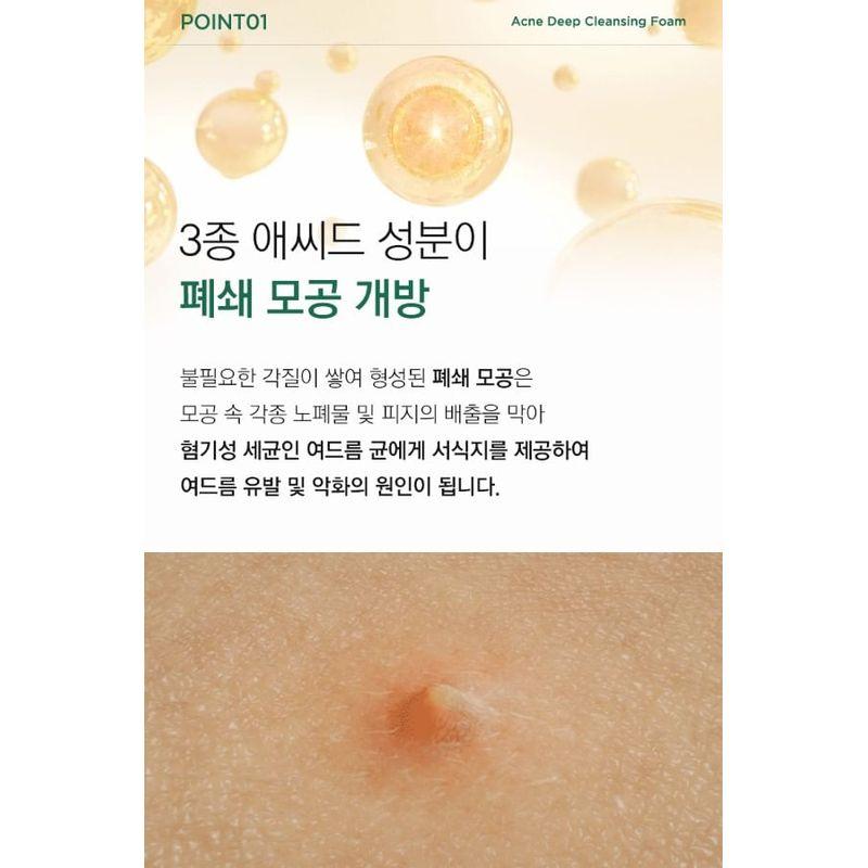 NATUREKIND Acne Deep Cleansing Foam 100ml