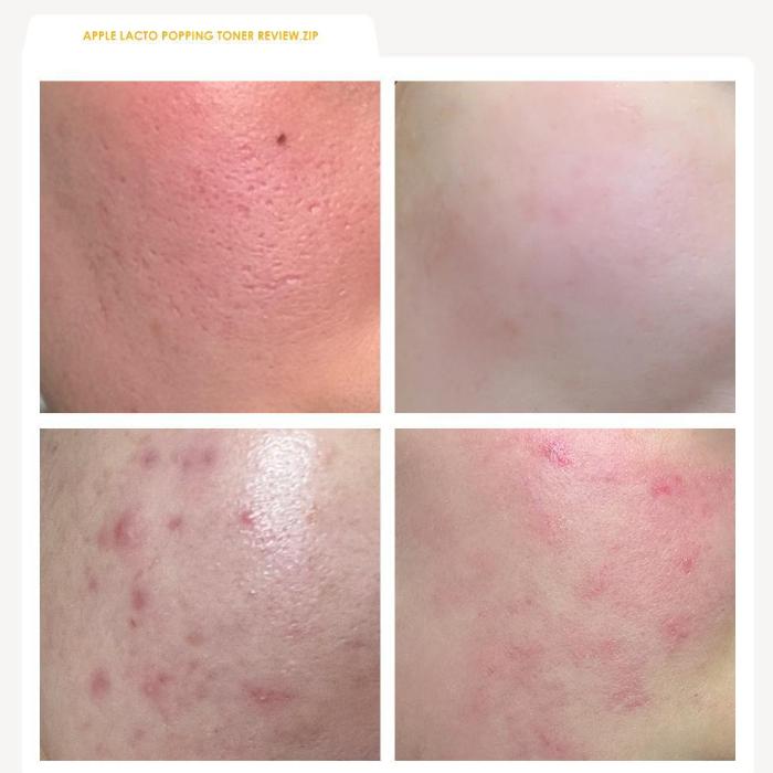 Rdrd Green Apple Lacto Rebalancing Popping Toner 95g