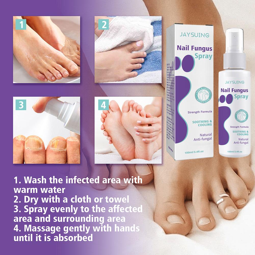 1/3/5PCS Nail Fungus Spray Reduce Beriberi Deodorize Remove Onychomycosis Paronychia Deeply Mild Cleansing Nail Care Spray