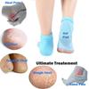 Purastep Silicone Gel Heel Socks For Dry Hard Cracked Heels Repair, Foot Care Support Cushion With Spa Botanical Gel Pad - For Men And Women - (F