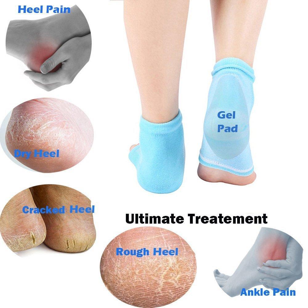 Purastep Silicone Gel Heel Socks For Dry Hard Cracked Heels Repair, Foot Care Support Cushion With Spa Botanical Gel Pad - For Men And Women - (F
