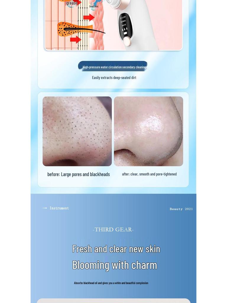 Shuaige Nuo 2112A Ultrasonic Pore Cleanser Blackhead Remover