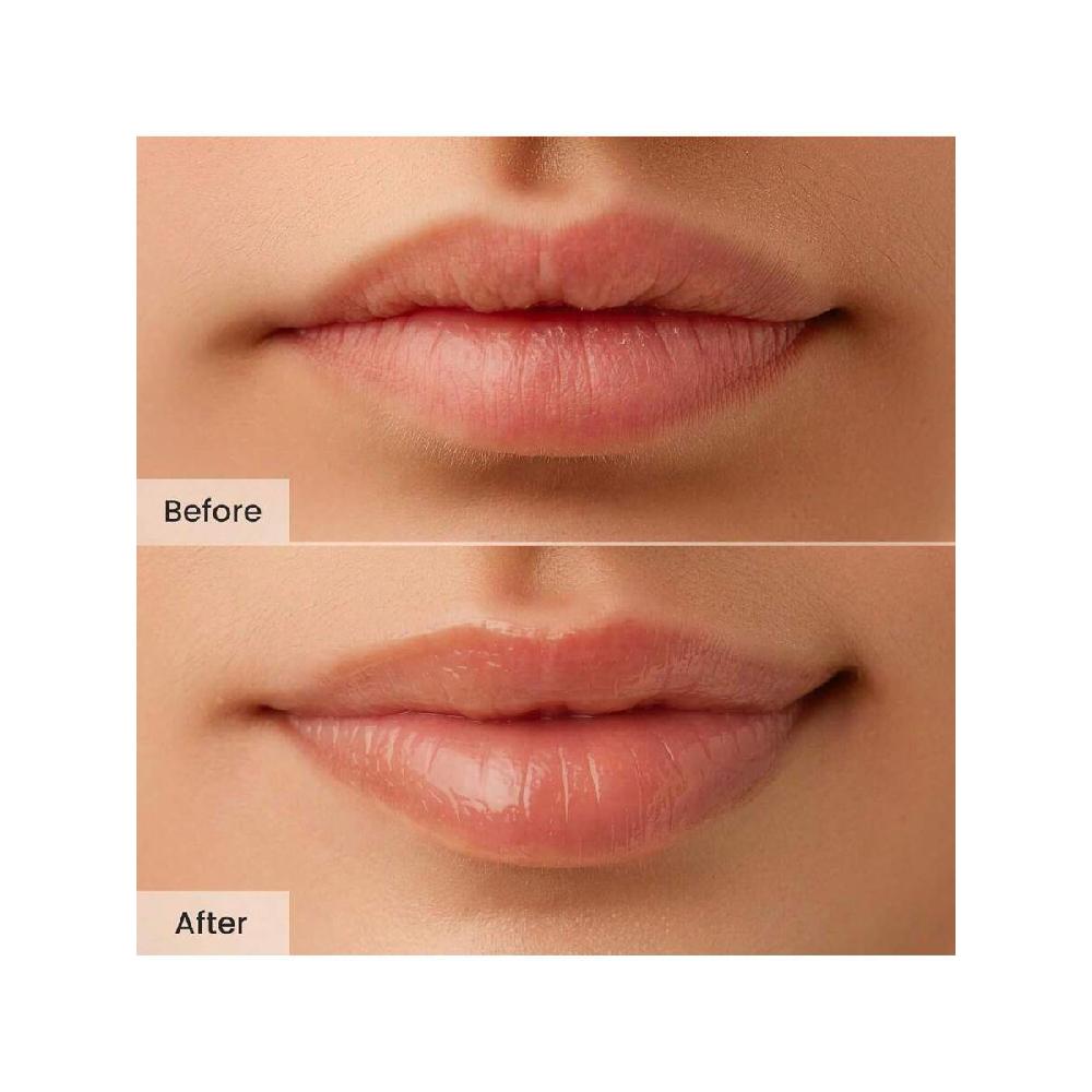 CNP Propolis Lipcerin 15ml Baume à Lèvres Hydratant de Nuit au Manuka & Masque, Hydratation Longue Durée 12h