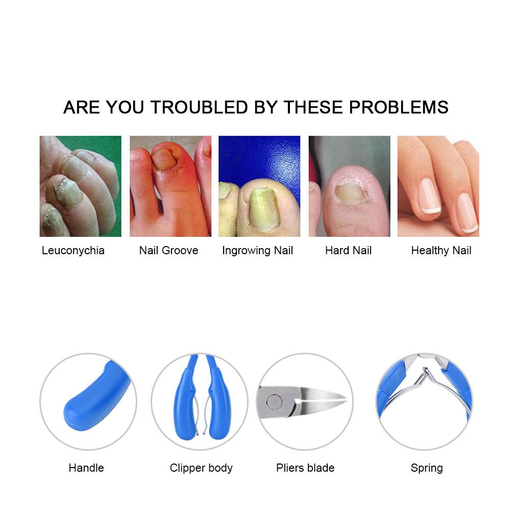 Stainless Steel Ingrown Toe Nail Clippers Fingernail Toenail Cuticle Scissors Pedicure Cutter