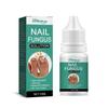 Extra Strong Nail Fungus Treatment Serum Essence Care Repair Essence Anti Toe Infection Gel Feet Serum Removal Nails Fungal