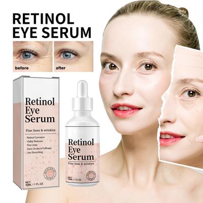 Retinol Eye Cream, Fade Fine Lines Around The Eyes, Eye Bags, Black Circles, Tighten And Moisturize The Eye Skin 30ml