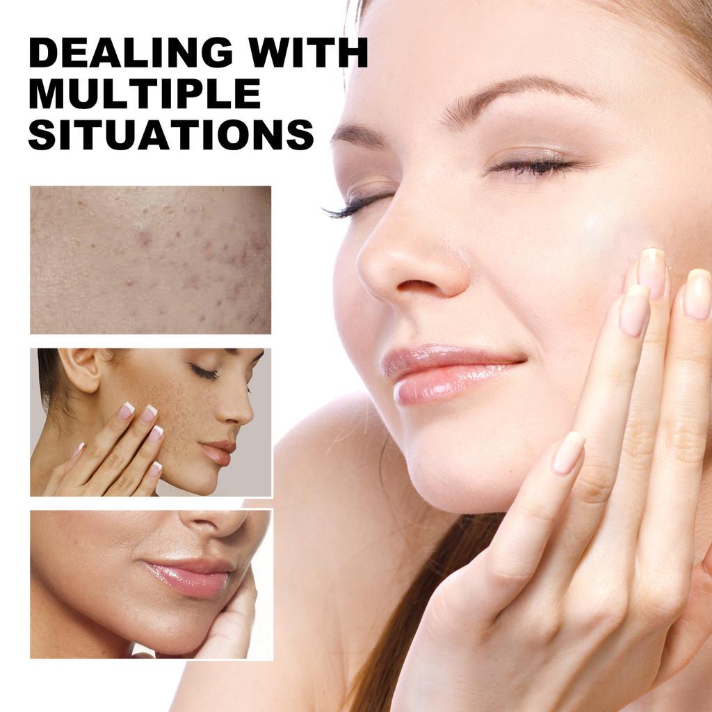 Eelhope Cleansing Gentle Pads For Flawless Skin Brightening And Pore Refining Care Beauty