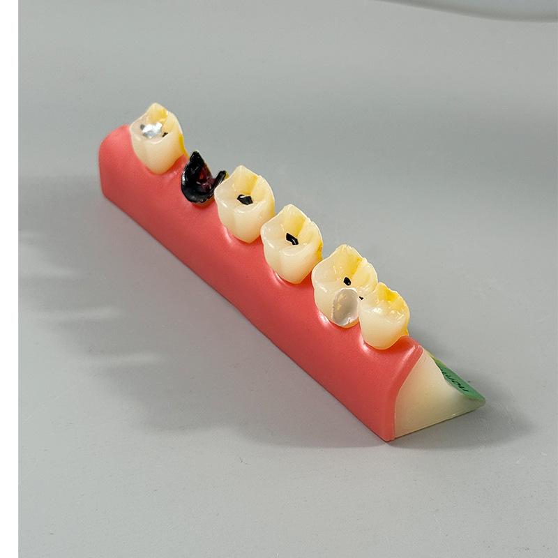 Прозора Знімна Повна Модель Щелепи з М'якими Яснами та Зубами для Підготовки до Імплантації