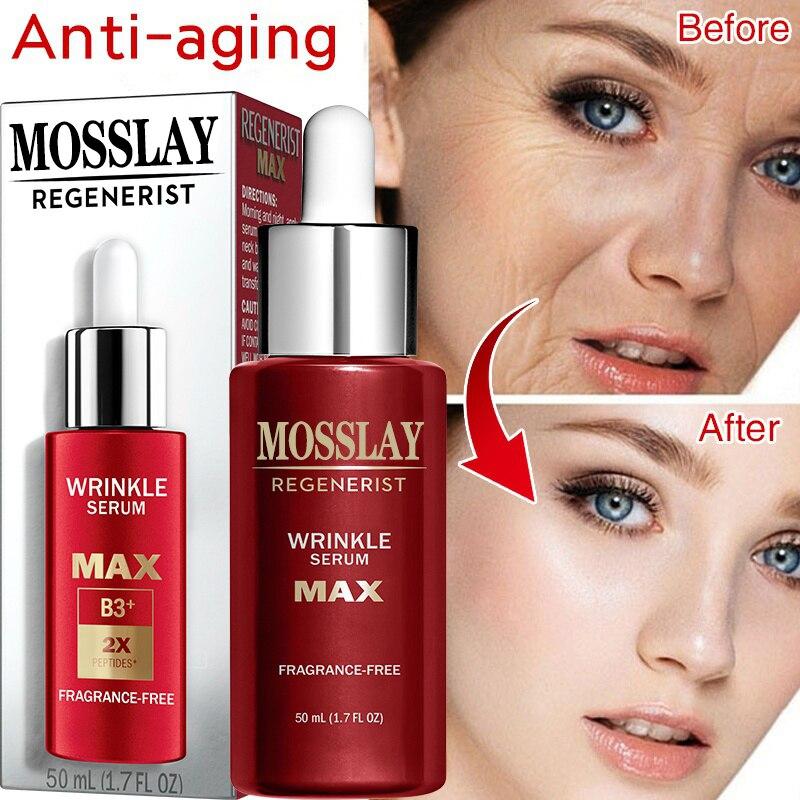 

NEW Ретинол Сыворотка для лица Против морщин Удаление темных пятен Эссенция Для лица Антивозрастное отбеливание Уход за кожей лица Сыворотка для ухода за кожей лица