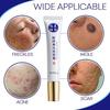 Strong Effects Whitening Freckle  and Acne  Fading Stain 