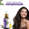 Sesa Rosemary Essential Oil 30ml For Hair Growth & Skin, Natural Hair Fall Control Oil For Men & Women, Pure Aromatherapy Diffuser Oil