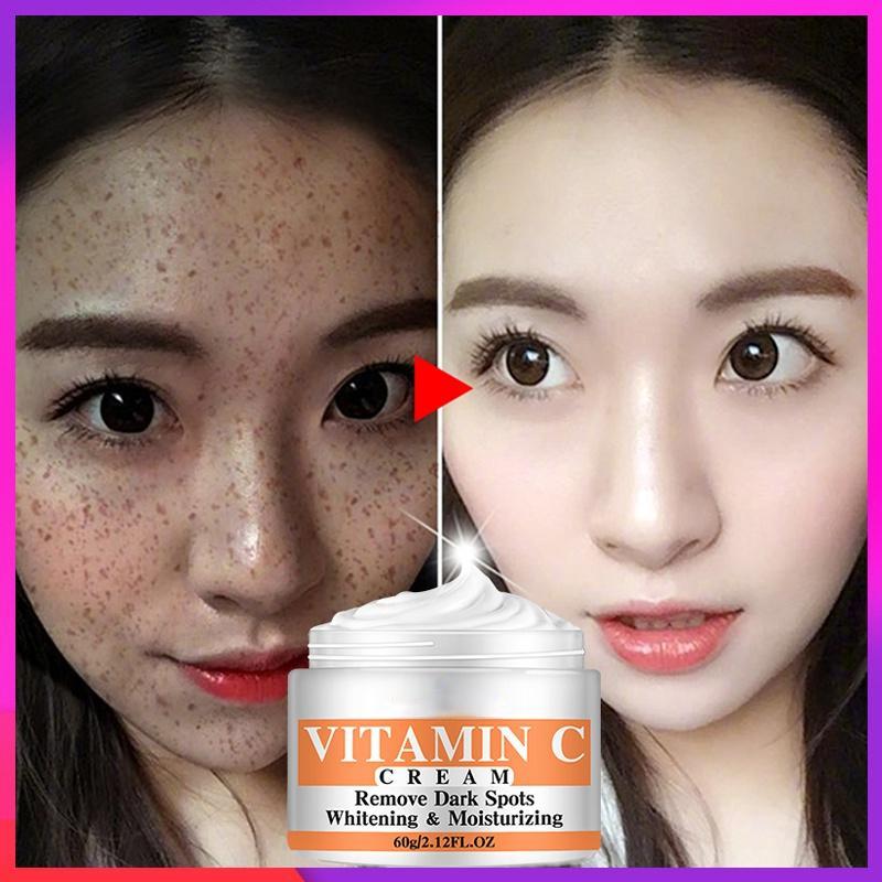 Neueste Vitamin C Whitening Gesichtscreme Reparatur Verblassen Sommersprossen Entfernen Dunkle Flecken Melanin Entferner Aufhellende Gesichtscreme