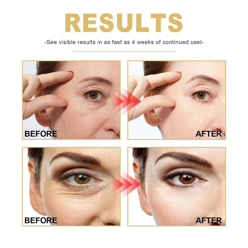 Anti-Wrinkle Freezing Age Youth Essential Oil, Moisturizing And Firming Skin, Fading Fine Lines And Brightening Skin Tone Essence