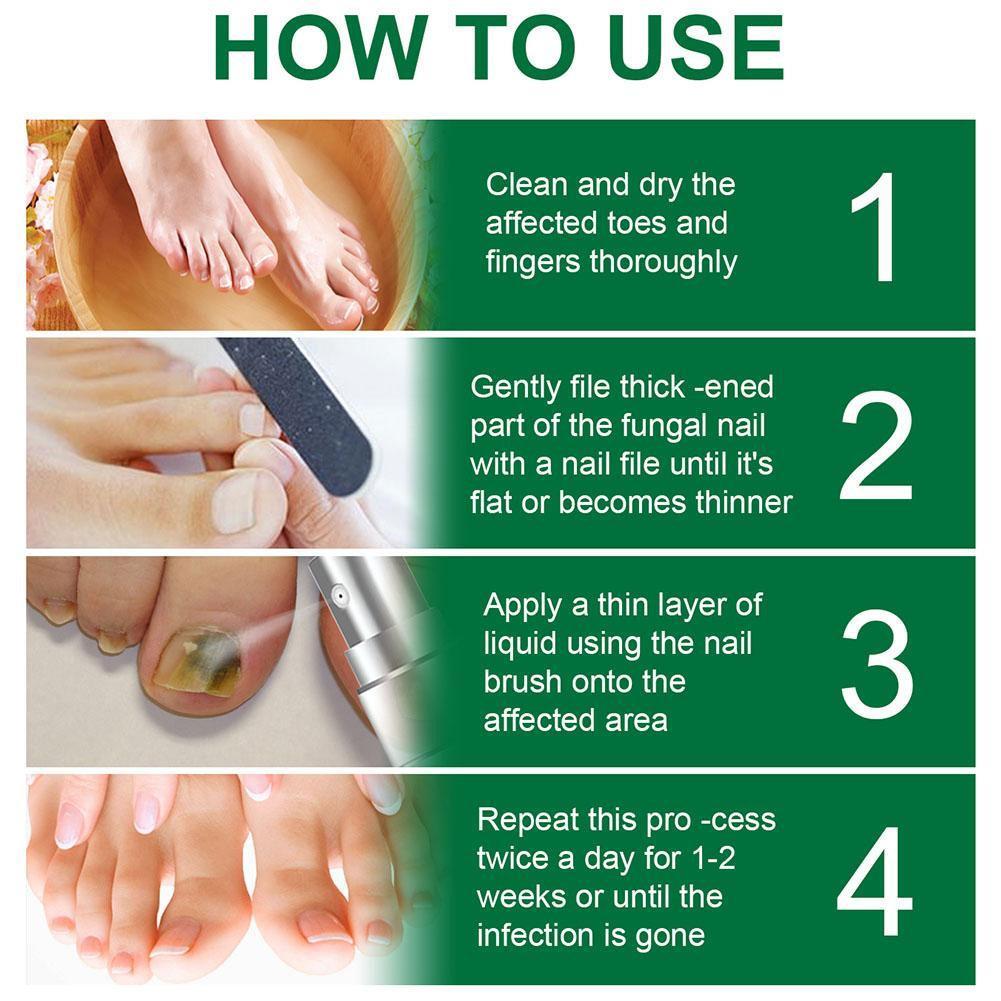 10ML Toenail Nail Fungus Treatment Repair Fingernail Device Foot Toenail Fungus Essential Care F0N3