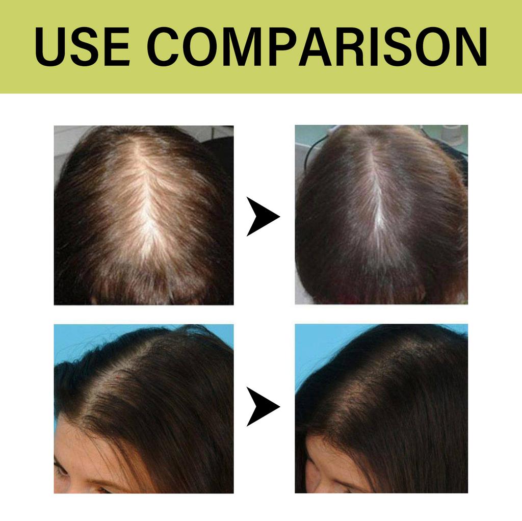 Huile d'Amla Originale Croissance des Cheveux Hydratante Lissante Réparateur Cheveux Abîmés Secs Frisés Pointes Fendues Traitement Cuir Chevelu Masque Capillaire Après-shampoing