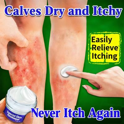 Fast Anti-Itch Cream for Eczema & Fungal Infection, Relieves Skin Allergies & Dermatitis, Antiseptic Care 50g