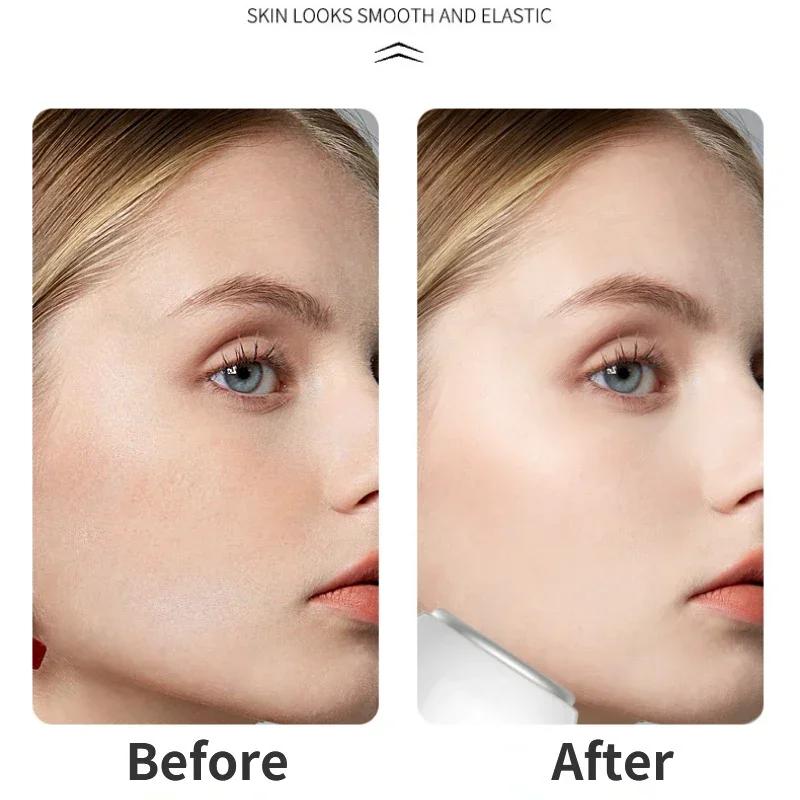 Face Skin Ice Roller Cooler Skin Lifting Face Cooling Massager Ice Compress Calm Skin Ice Cooler Eye Pouch Cooler Edema Remover