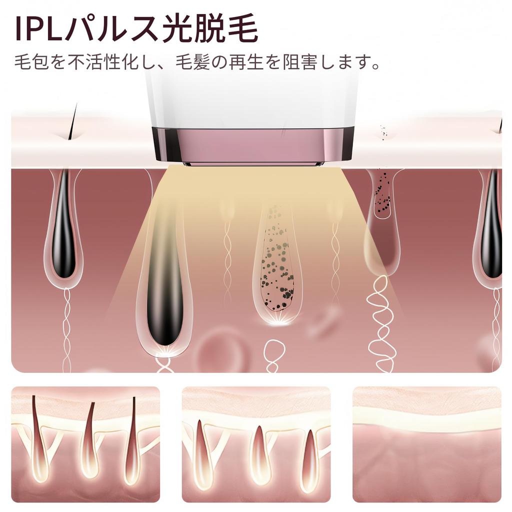 compatible with optical hair removal IPL optical hair removal for men and irradiation painless hair hair removal salon unwanted hair optical beauty
