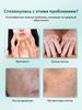 Ointment for vitiligo