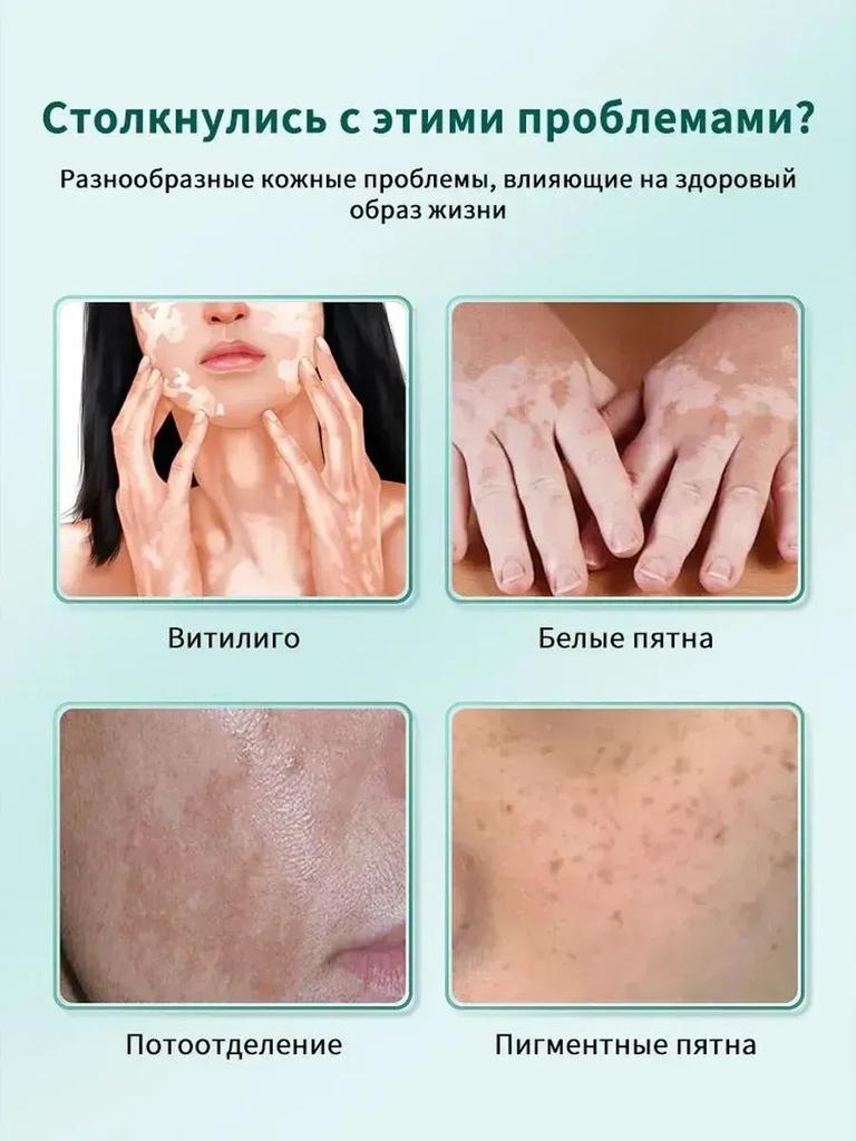 Ointment for vitiligo