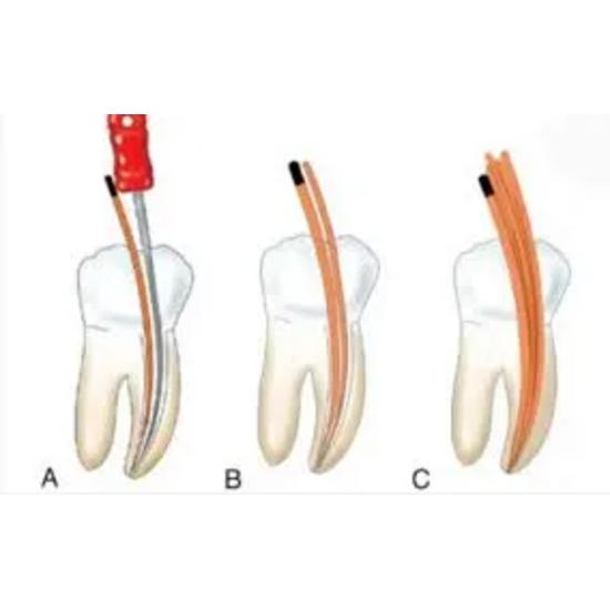 Mani Finger Spreaders 25mm