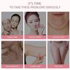 Face Lifting Roller RF Double Chin V Face Shaped Facial Massager Jaw Cheek Thin Slimming Facial Lift Up Belt Skin Care Tool