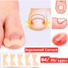 12/30/54PCS Health Care Professional Toe Nail Care Pedicure Tools Ingrown Toenail Foot Corrector Stickers Toe Nail Repair Paronychia Treatment