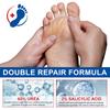 Urea Foot Care Cream, Moisturizing And Exfoliating Foot Care Stick, -drying And Cracking, Non-greasy 40g