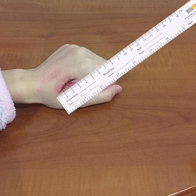 Paper Tape Measure Disposable Wound Measuring Ruler Educare Measuring Tape Wound Measurement Tool Me dical Measurement
