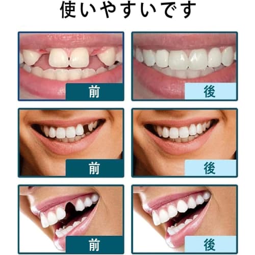 2 Pairs of Dentures, False Teeth, Natural and Comfortable Fit, Smile Now with Comfortable Fit - Matching Upper and Lower Sets, Men's and Women's Insta