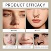 The Nose Fits The Nose Shape Closely And Is Not Easy To Off. It Is Compatible With Most Nose Shapes During Sleep.
