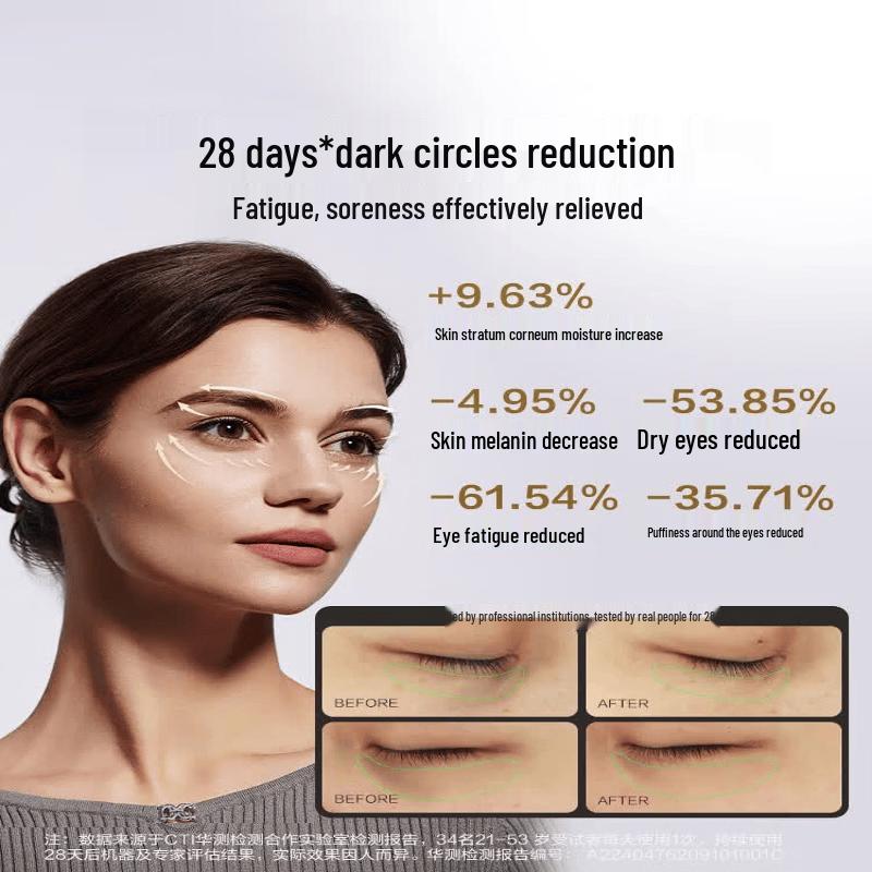 SKG E9 Smart Eye Massager CN Plug (adapter Included)