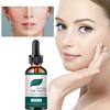 5ML/15ML/30ML/50ML/Salicylic Acid 2% Solution Essence Acne Spot Removing Shrink Pores Oil-Control Brighten Face Skin Vitamin C Serum for Face