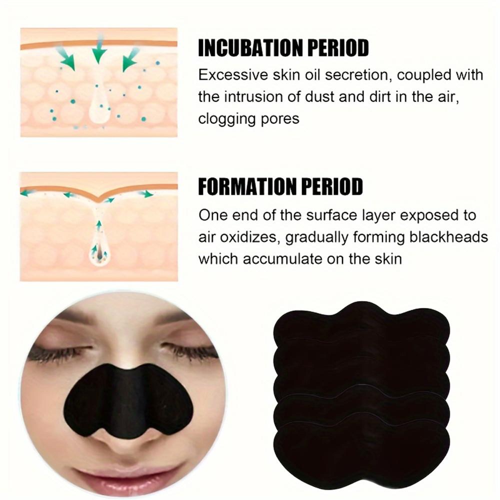 10/20/50/100PCS Unisex Nasal Strips Blackhead Remover Mask Acne Pimples Treatment Patch Shrink Pores Nose Stickers Skin Care