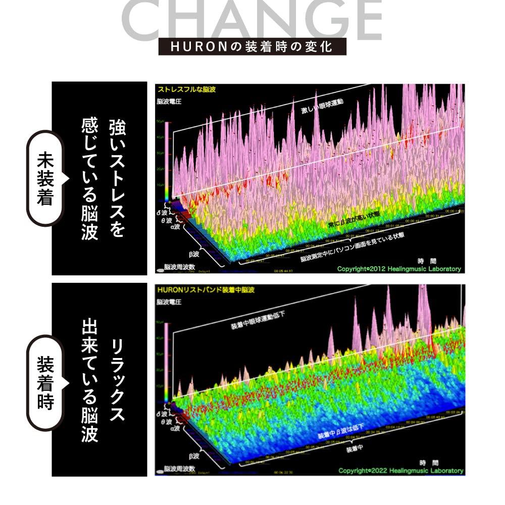 Huron Recovery Bands Size for Both Recovery Autonomic Nervous Sleep Support (2-Pack), Unisex, M, Arms, Wear, System,