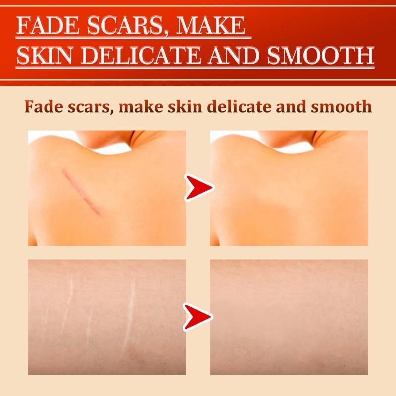 South Moon Centella Scar Repair Cream Moisturizing Skin Tightening And Smoothing Formula For Scars And Blemishes